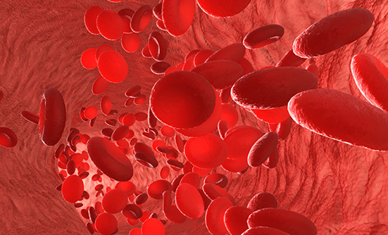 Genetic Influences in Multiple Myeloma