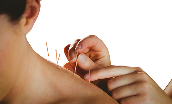 Chemo Side-Effects Relief with Acupuncture, a Centuries-Old Treatment