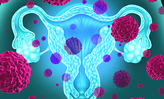 Advances in the Treatment of Cervical Cancer