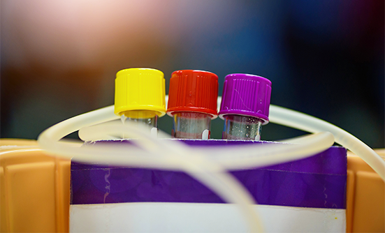 Understanding dMMR and MSI-H Tumor Biomarkers