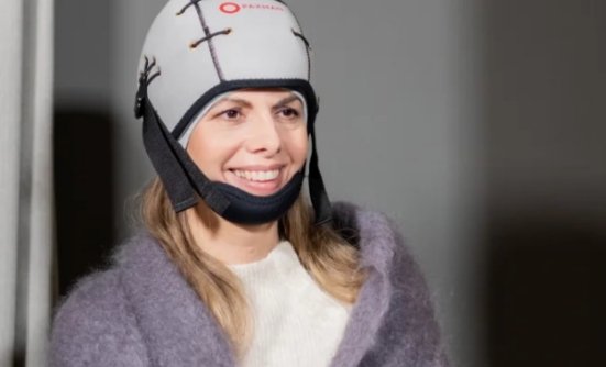 Is It Possible to Prevent Hair Loss?