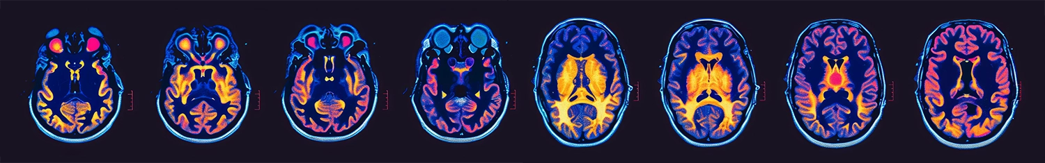 Brain Scans