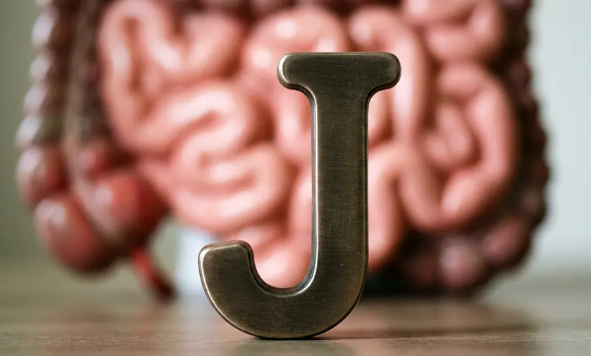 J is for...